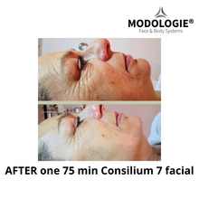Load image into Gallery viewer, Consilium 7 facial device
