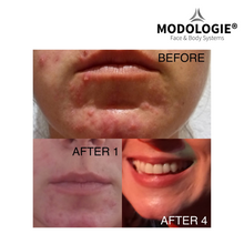 Load image into Gallery viewer, Consilium 7 facial device