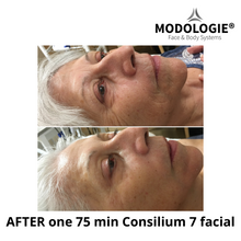Load image into Gallery viewer, Consilium 7 facial device