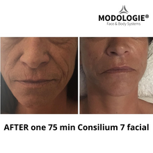 Load image into Gallery viewer, Consilium 7 facial device